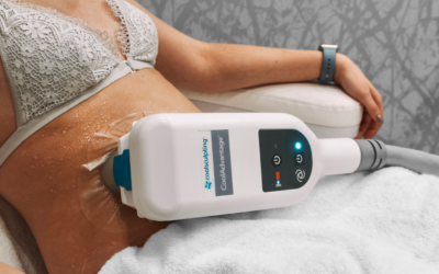 Coolsculpting on a patient