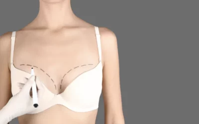 Breast Augmentation - Plastic Surgery Vancouver, Rejuvenation Coal Harbour, Dr. Diana Forbes